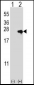 NME4 Antibody (N-term)